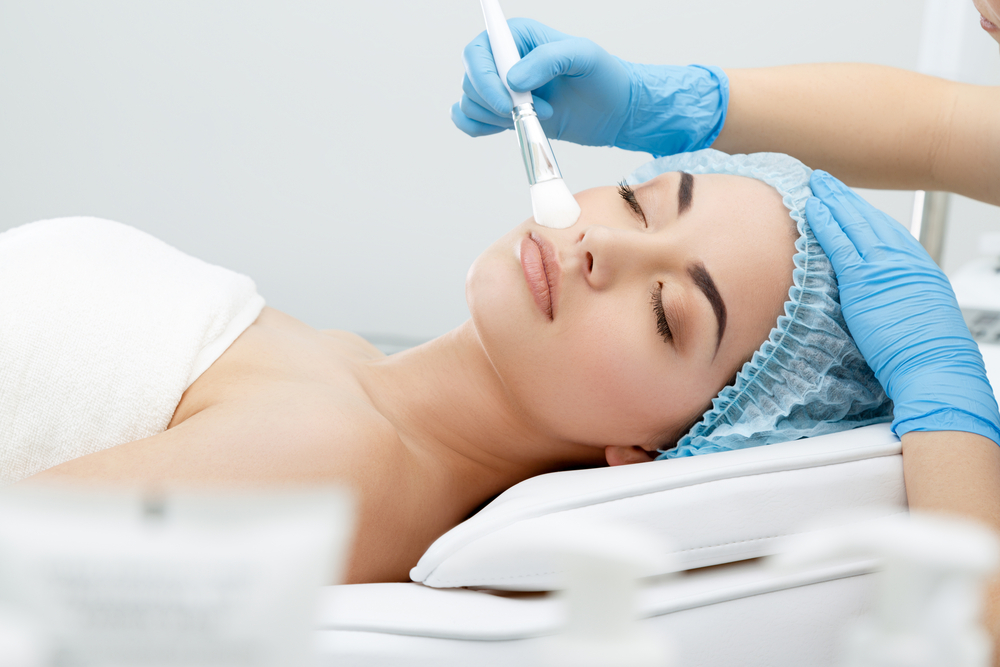 chemical skin peels Preston